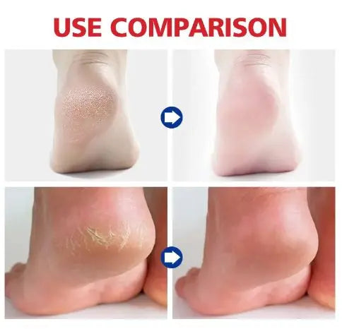 Aichun Beauty Moisturizing Foot Cream Dead skin care cream EasyShop Mini Mart